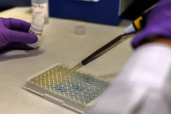 El test ya está disponible y accesible para los ciudadanos de toda España a través de la extensa red de laboratorios clínicos de Eurofins Megalab en todo el país.