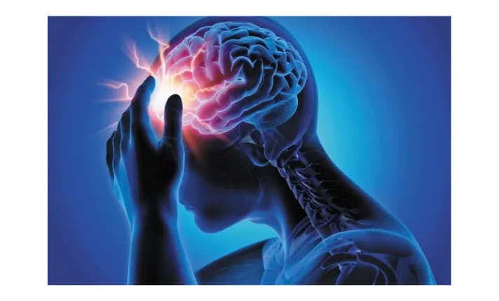 BCN HEALTH publica un estudio sobre el manejo y costes de la cefalea y la migraña en España