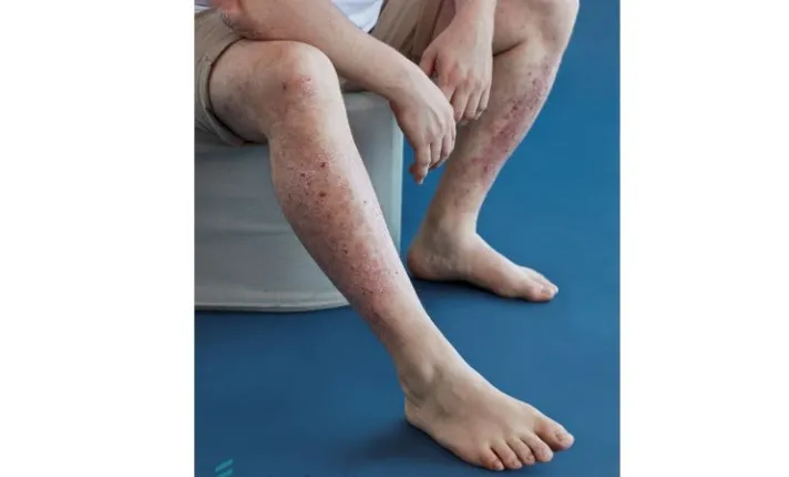 Noticia Perspectivas Octubre Almirall