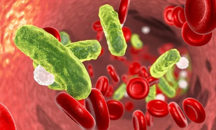 BCN HEALTH publica un estudio evaluando la situación epidemiológica y el coste de la sepsis en España  