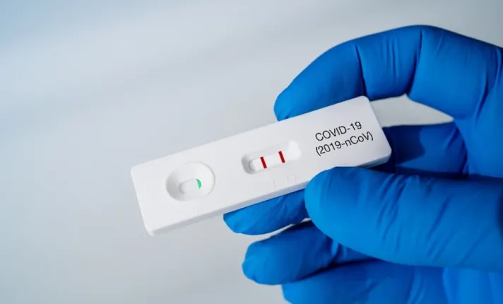 Estudios del funcionamiento de test IVD para SARS-CoV-2.jpg