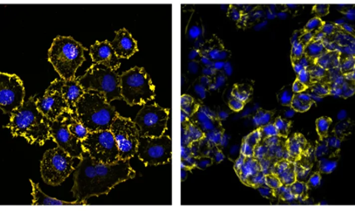 Cultivos 2D (izquierda) vs Cultivos 3D (derecha)