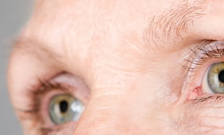 Glaucoma_biotecnología_AseBio