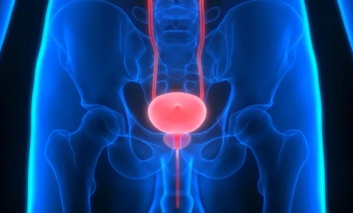 foto_recurso_cancer_prostata