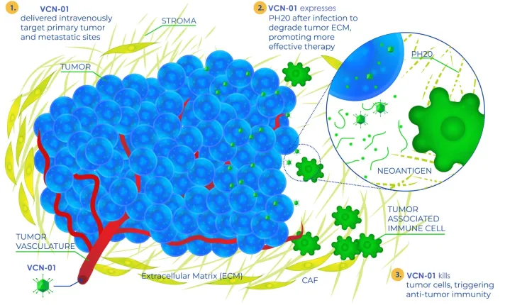 Infografía informativa 