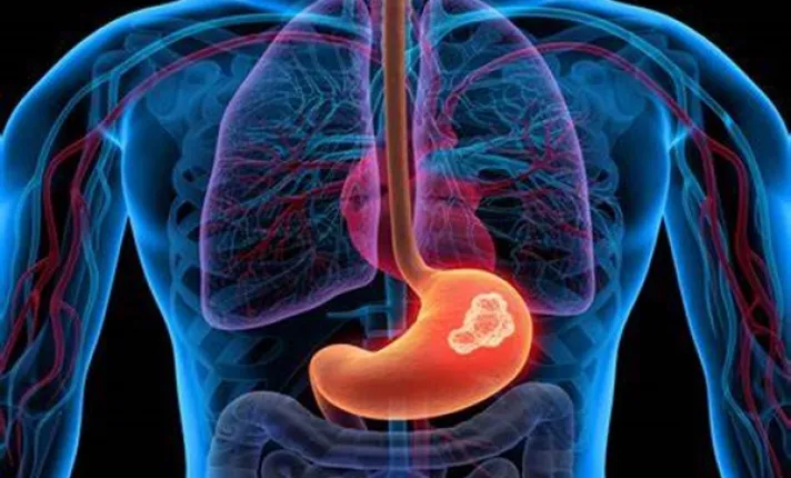 Dibujo de un estómago