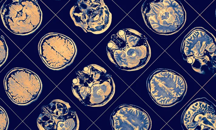 Imatge recurs nota PERIS_1738749605 (1).png