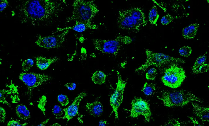 AEMPS autoriza el ensayo clínico AP Molefy Pharma para tratar la ELA