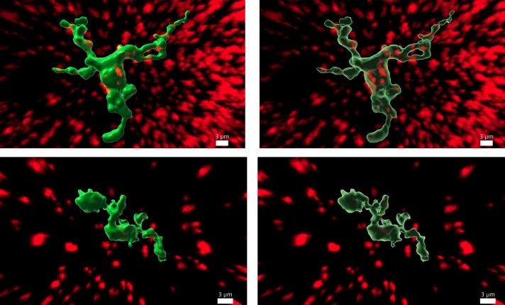 Imagen de microglias neuronas
