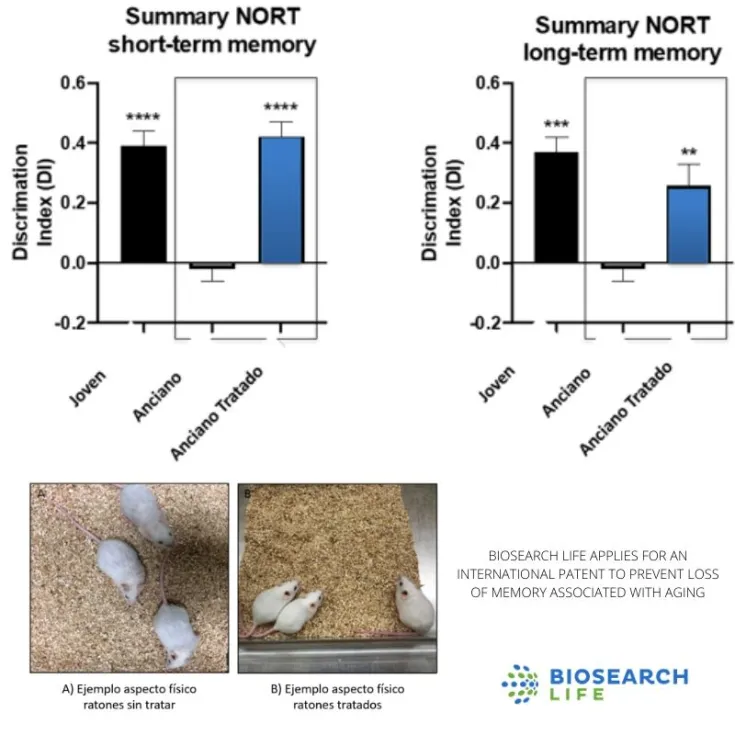 Biosearch Life solicita una patente internacional para evitar la pérdida de memoria asociada al envejecimiento