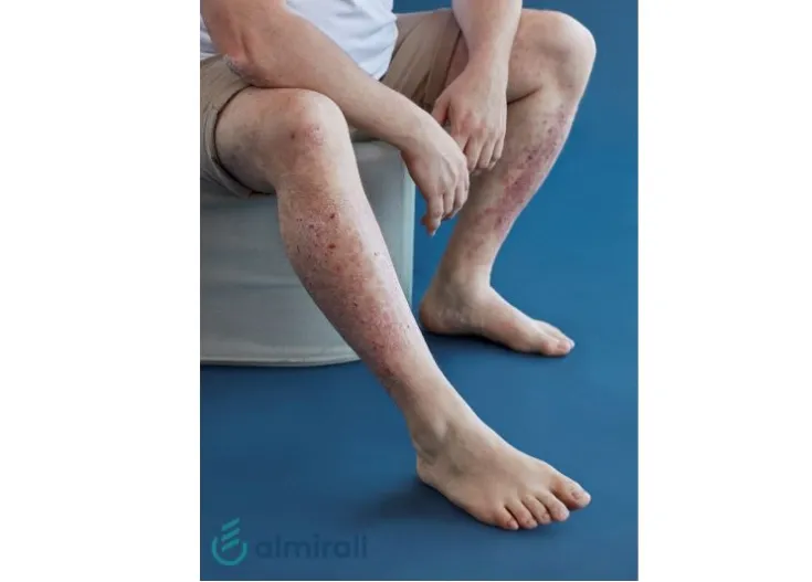 Noticia Perspectivas Octubre Almirall