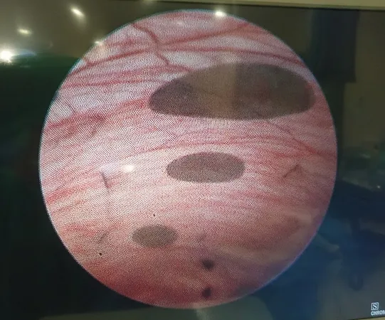 Placenta de oveja embarzada a la que se le han colocado 3 parches 