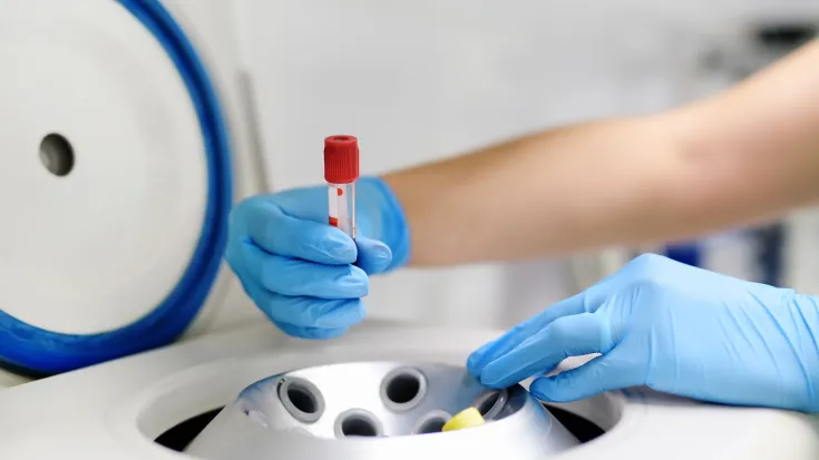 prevecol-amadix-noticia-biotech