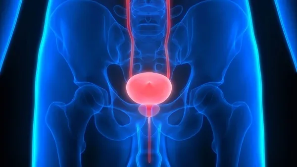 foto_recurso_cancer_prostata