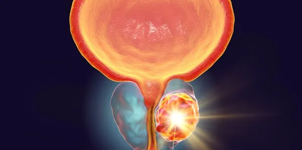 Imagen generada por inteligencia artificial de una próstata