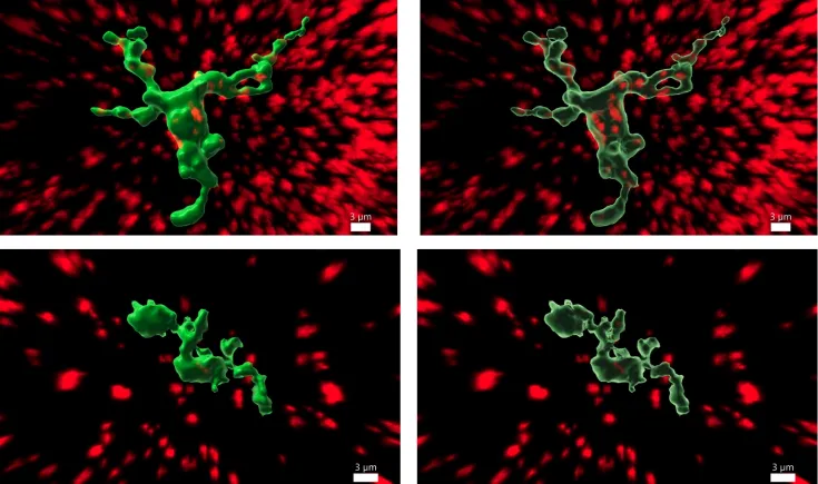 Imagen de microglias neuronas