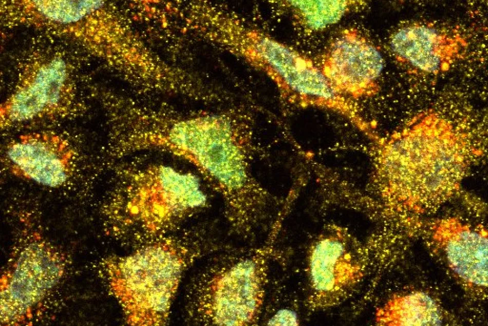 Imagen de células HeLa realizadas con microscopio confocal.